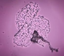 Graphenoxid im Impf-Serum Graphenoxid