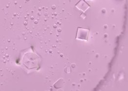 Nanobauteile im Impfstoff Verschiedene Nanobauteile in der Injektionsflüssigkeit